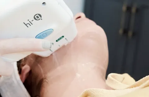 Non-Surgical Facelift in Perth: HIFU Explained