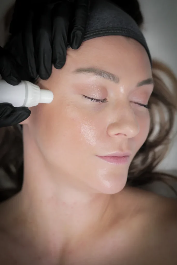 Real Stories of Acne Scar Reduction and Skin Renewal